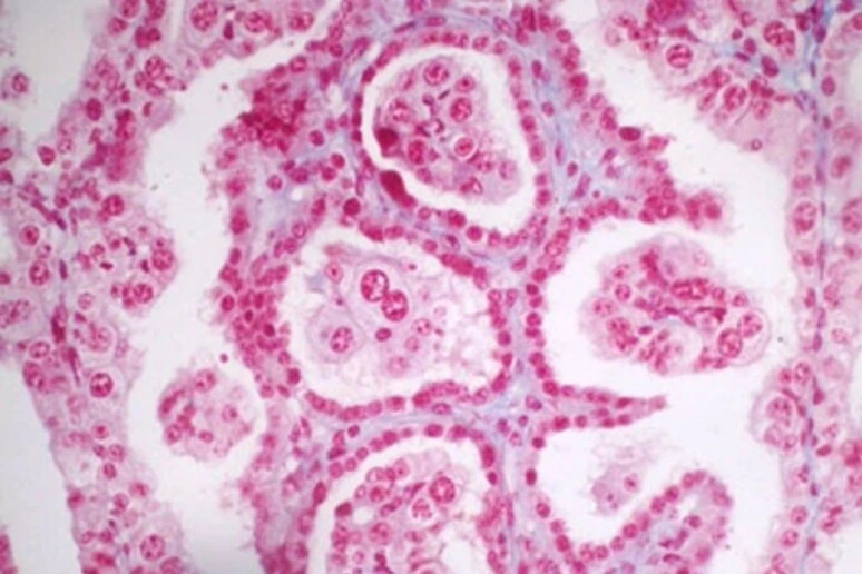 Pronta la mappa cellulare della zona di contatto tra madre e feto