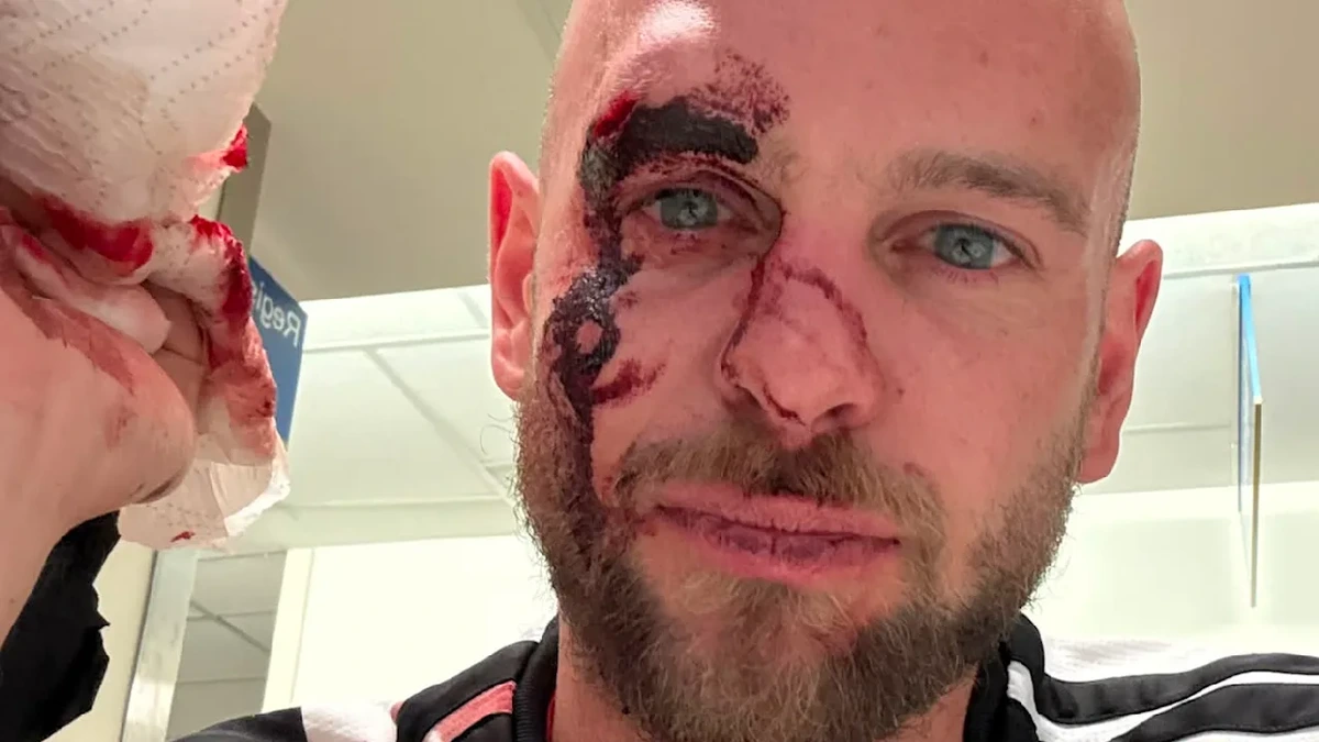 DFB-Fan in Toronto verprügelt: „Ich wurde wegen eines Regenbogen-Fächers angegriffen“