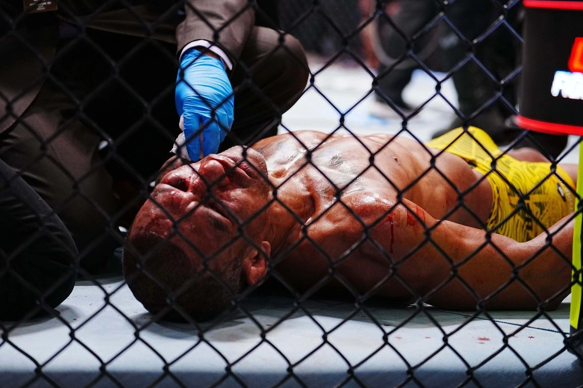 ВИДЕО | Пугающие кадры из UFC — звездный боец потерял сознание прямо во время поединка