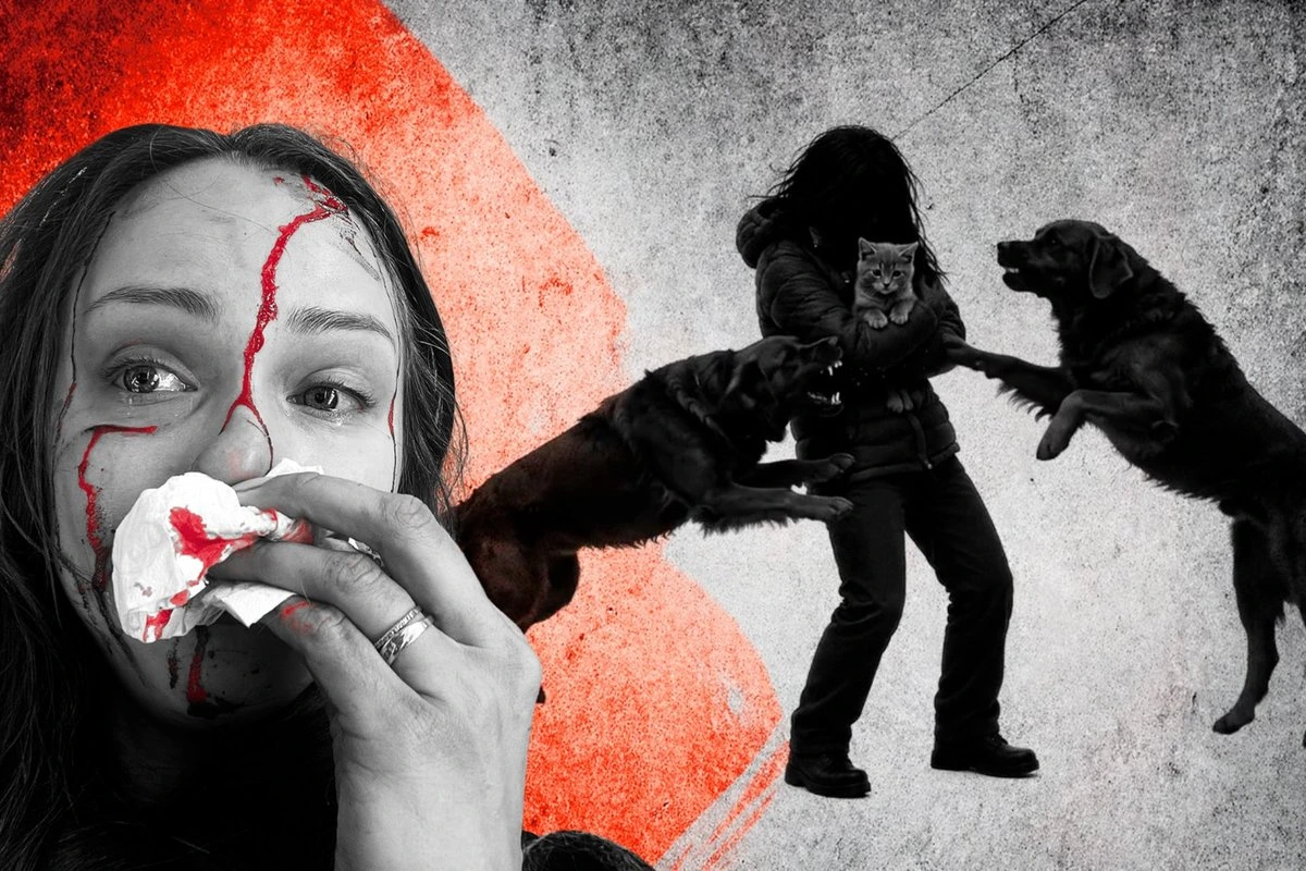 В Таллинне собака покусала женщине лицо, хозяина даже не оштрафовали