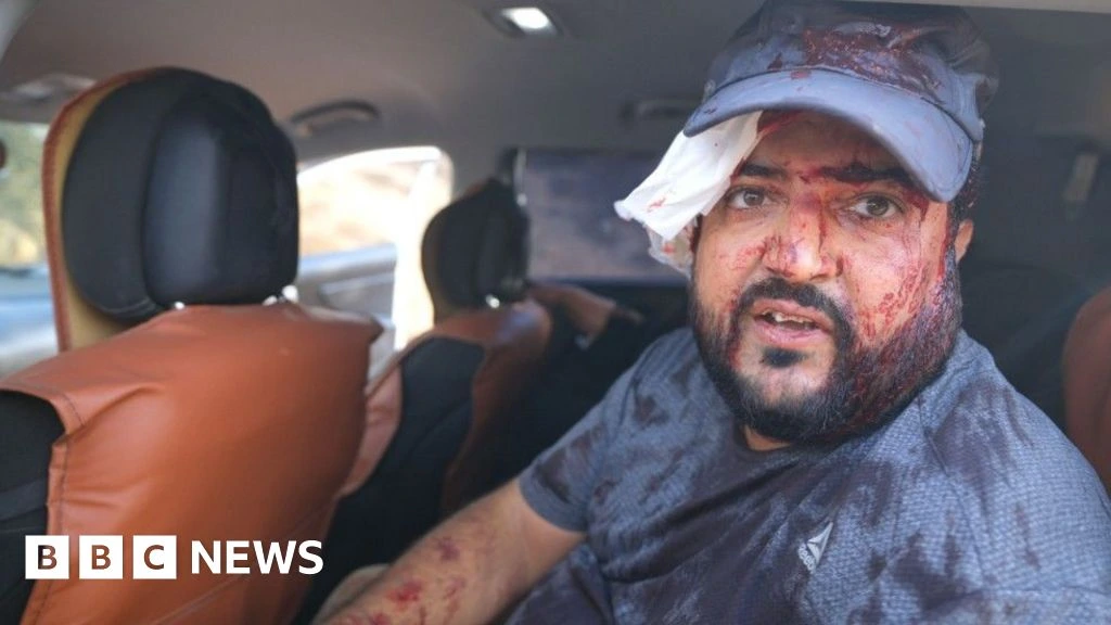 Palestinians and US journalist injured by Israeli settlers in West Bank harvest attack
